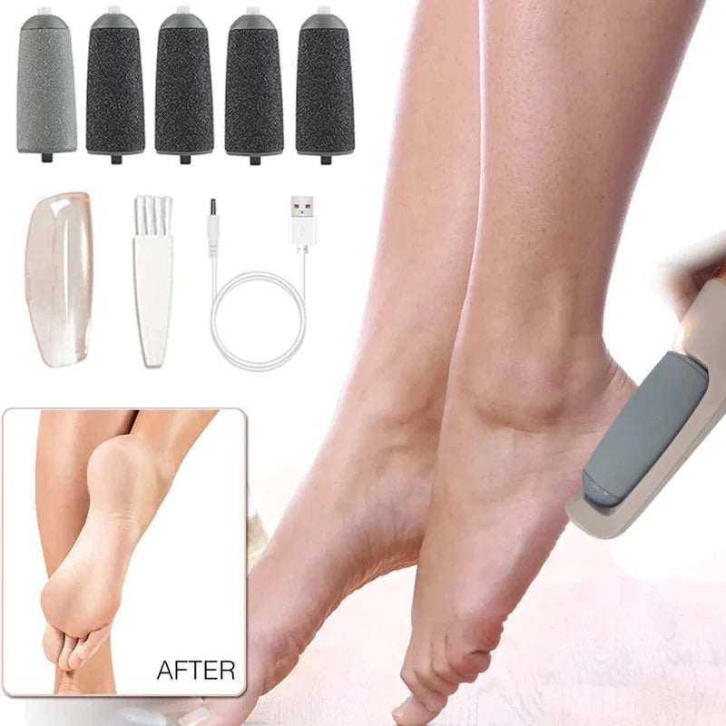 Rechargeable Electric Foot File-Callus Remover