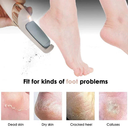 Rechargeable Electric Foot File-Callus Remover 